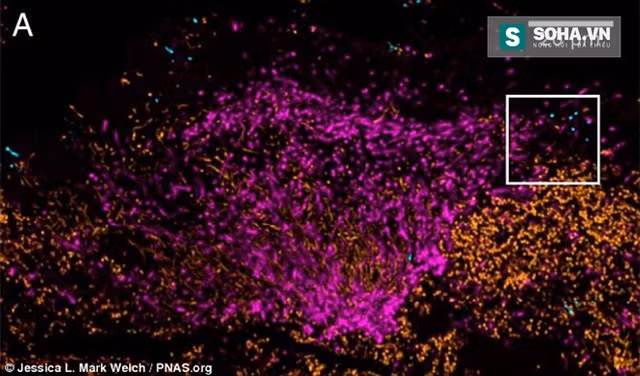  Tác phẩm vạn hoa do vi khuẩn trong khoang miệng tạo nên. 