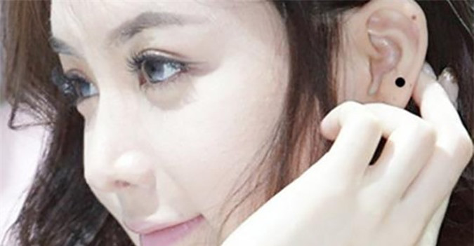 Đôi tai có nốt ruồi