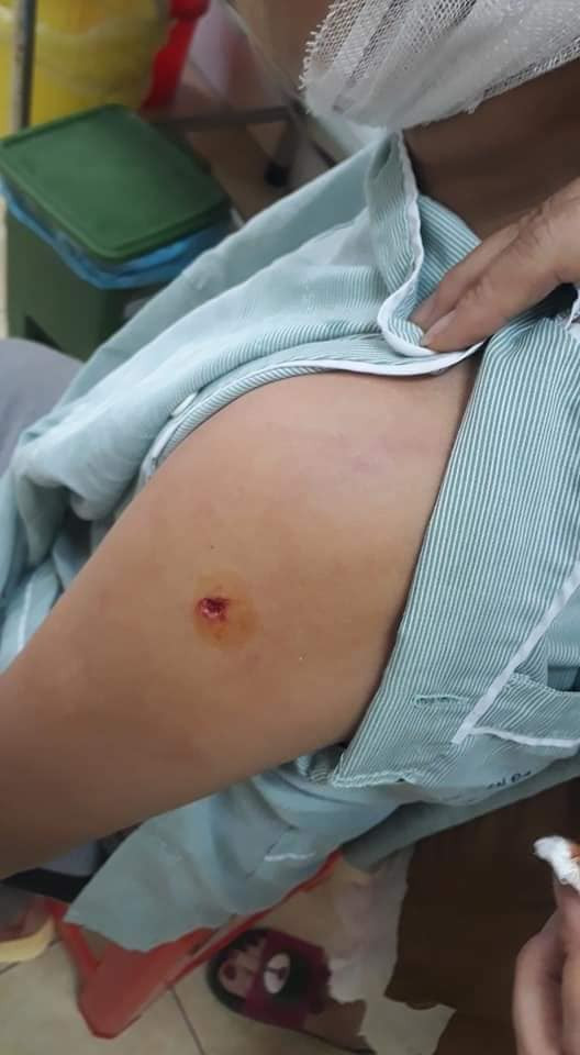 Nhiều vết thương trên cơ thể cháu Tuấn do hung thủ gây ra Nhiều vết thương trên cơ thể cháu Tuấn do hung thủ gây ra