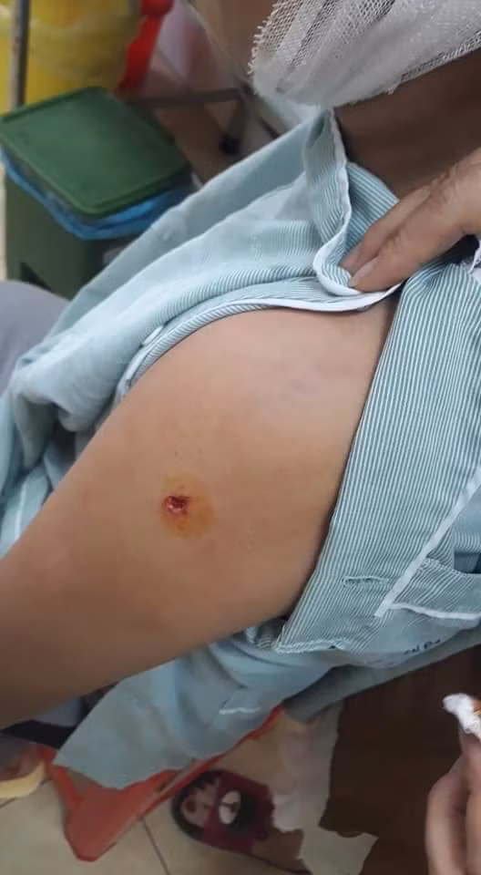 Nhiều vết thương trên cơ thể cháu Tuấn do hung thủ gây ra