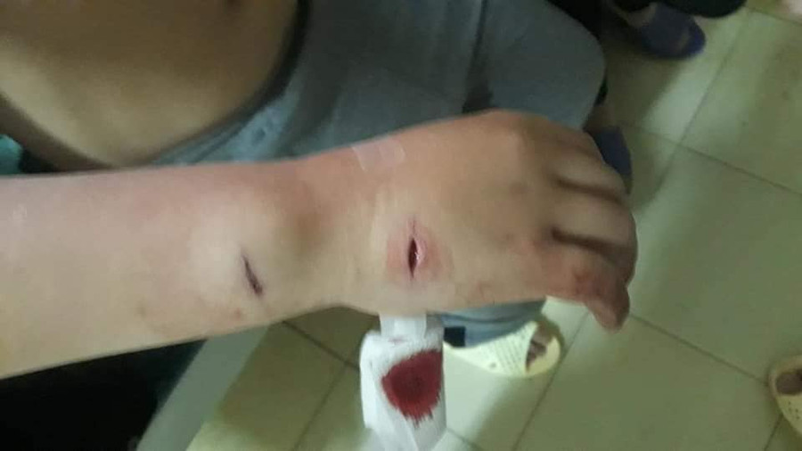 Đây là sự việc hy hữu xảy ra tại xã Thanh Chăn, huyện Điện Biên Đây là sự việc hy hữu xảy ra tại xã Thanh Chăn, huyện Điện Biên