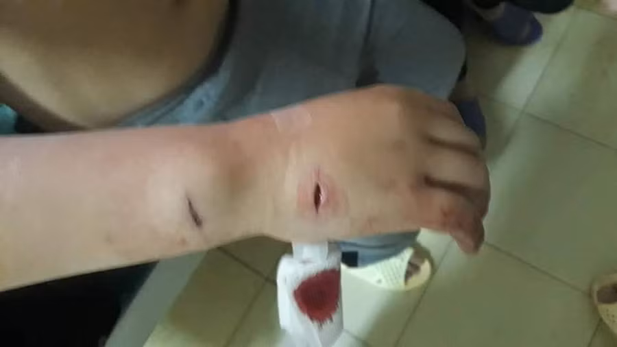 Đây là sự việc hy hữu xảy ra tại xã Thanh Chăn, huyện Điện Biên