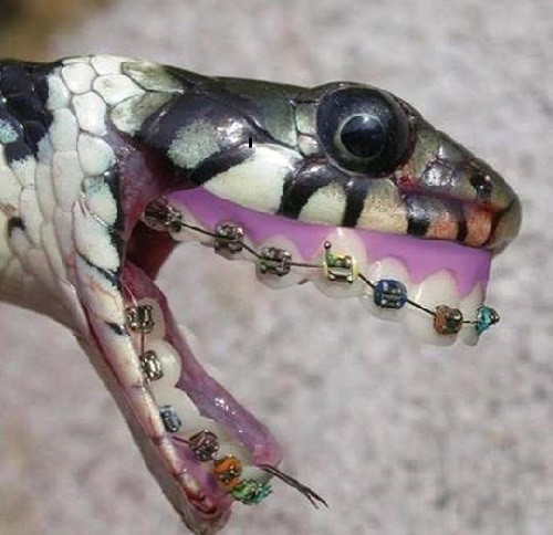 Khi rắn niềng răng.