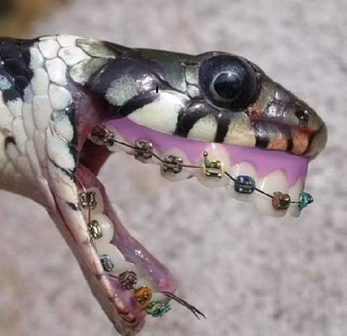 Khi rắn niềng răng.