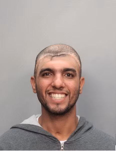  Mặc dù các nhà khoa học đã đưa ra nhiều giả thiết nhưng hiện tượng này tới nay vẫn là sự bí ẩn.