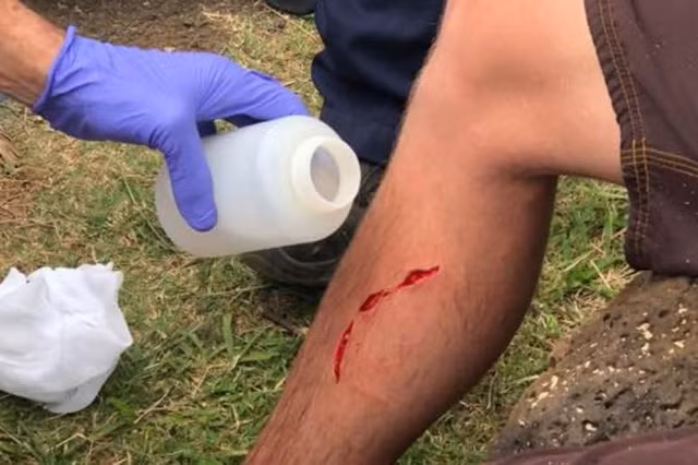 Người xui nhất quả đất: Bị rắn, gấu rồi cá mập tấn công