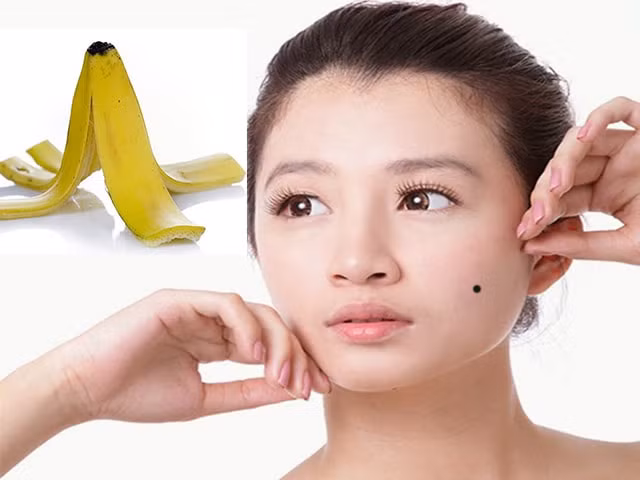 1575879772-341-cach-tay-not-ruoi-tai-nha-voi-nguyen-lieu-tu-nhien-an-toan-hieu-qua-tay-not-ruoi-tai-nha-4-1575433764-width640height480