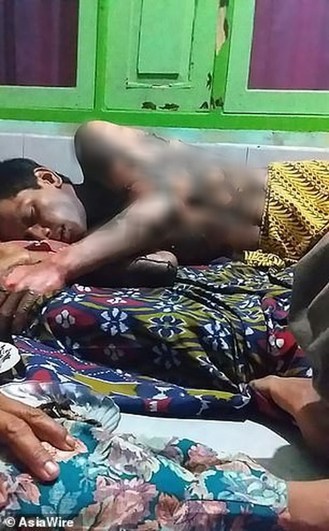 Indonesia: Vợ tẩm xăng thiêu chồng vì không chịu đưa mật khẩu điện thoại-4