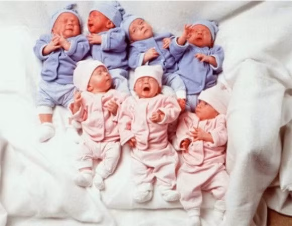 Ca sinh 7 sống sót đầu tiên trên thế giới hiện ra sao?