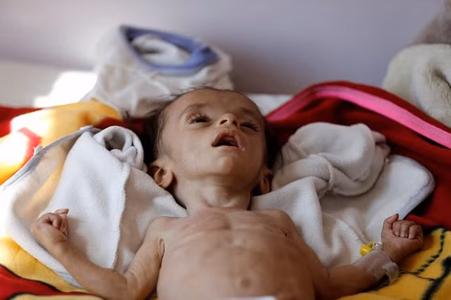 Căn bệnh bí ẩn từng giết hàng loạt hải tặc vào thế kỷ 18 đang dần xuất hiện - Hình 2