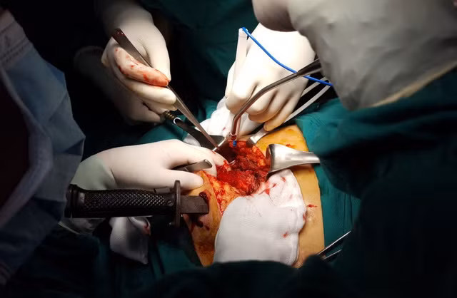 Cân não giành lại sự sống cho bệnh nhân bị dao cắm xuyên ngực