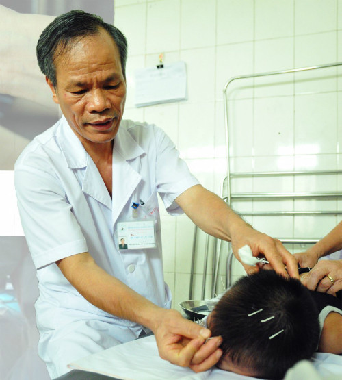 Bác sĩ Tâm đang châm cứu cho bệnh nhi. Ảnh: Thúy Quỳnh.