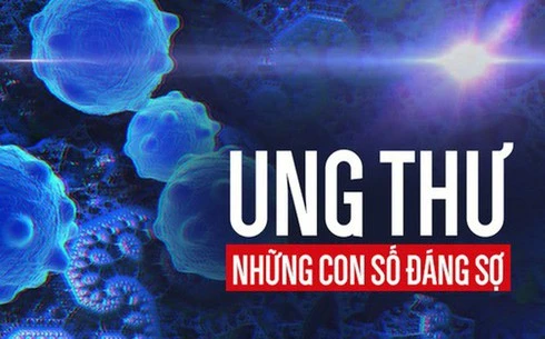 Ung thư là mối đe dọa lớn đến sức khỏe của mỗi người. Ảnh minh họa.