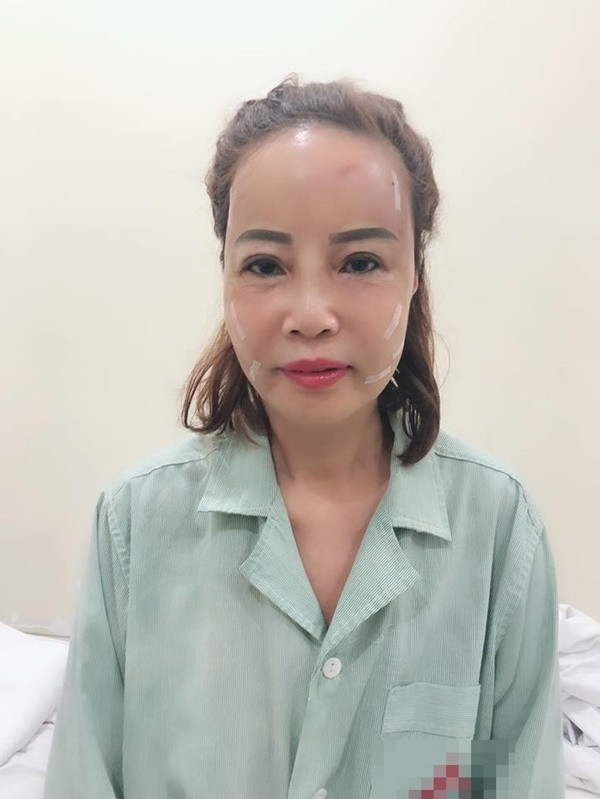 Hình ảnh chị Thu Sao sau khi làm đẹp.