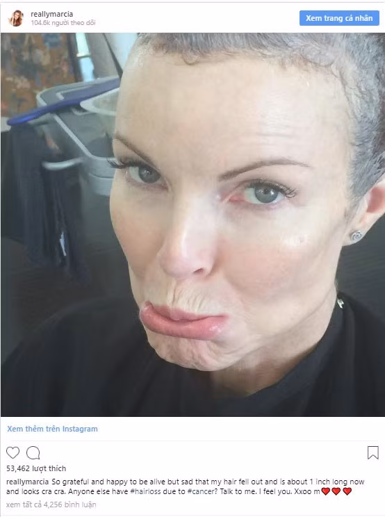 Dấu hiệu nhận biết sớm ung thư hậu môn - bệnh ung thư hiếm gặp đe dọa mạng sống của nhiều người nổi tiếng - Ảnh 2.