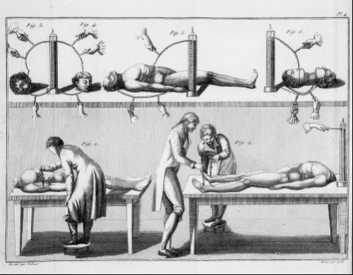 Mô tả thí nghiệm của Aldini. Mô tả thí nghiệm của Aldini. Ảnh: Wellcome Collection, CC BY-SA.