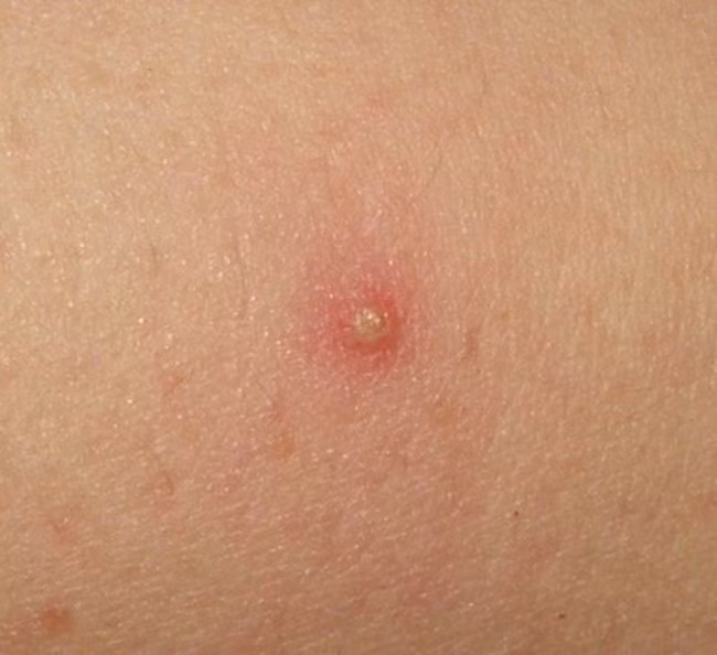 nhũng nguy co dáng sọ khong thẻ ngò khi nam giói di cát tóc ỏ tiẹm hinh anh 1