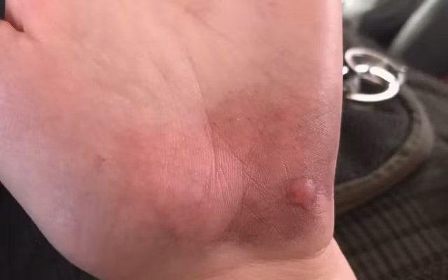 Con đi học về với đôi bàn tay trầy trụa, mẹ báo nhà trường và cảnh sát vào cuộc điều tra ngay lập tức ảnh 5