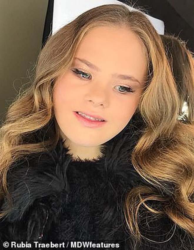 Câu chuyện kỳ diệu của người mẫu 15 tuổi mắc hội chứng Down với 50 nghìn lượt follow trên Instagram - Ảnh 2. Câu chuyện kỳ diệu của người mẫu 15 tuổi mắc hội chứng Down với 50 nghìn lượt follow trên Instagram - Ảnh 2.