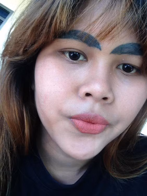 Cô gái trẻ phải chấp nhận sống với đôi lông mày kỳ khôi nhiều tháng trời