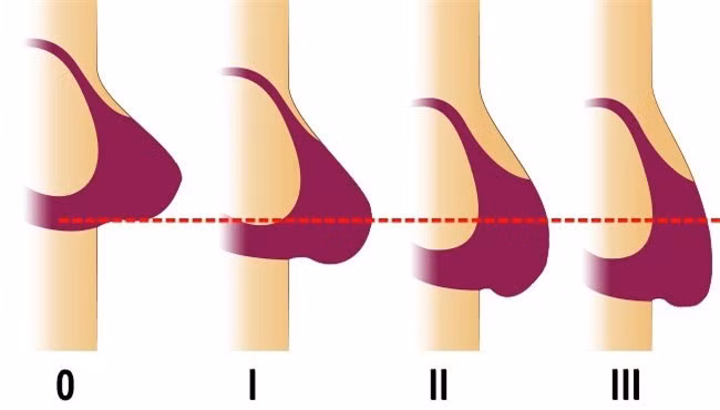 7 vật dụng trong nhà rất có ích nhưng lại làm hại sức khỏe, nhan sắc và khiến bạn già nhanh hơn - Ảnh 7.