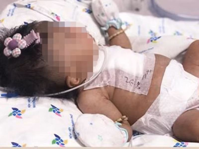 Bé gái sinh non nặng 2kg bị đa dị tật tim hồi sinh kỳ diệu