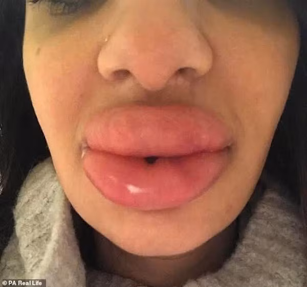 Giật mình những thảm họa "dao kéo" ảnh 2