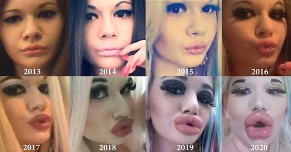 Giật mình những thảm họa "dao kéo" ảnh 10