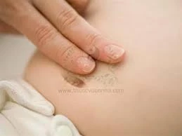Đắp rốn và và ngồi chờ điều kỳ diệu xảy ra