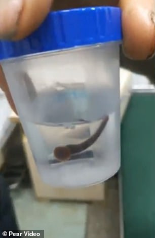 ho khong ngung suot 2 thang, di kham ta hoa phat hien con vat kinh di song trong mui va hong hinh anh 3