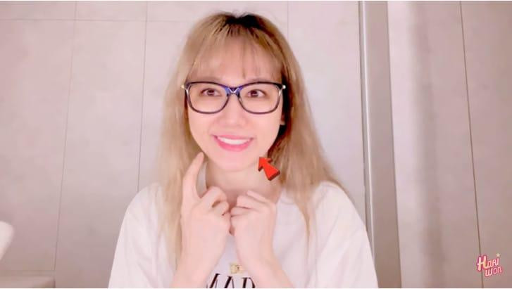 Trải qua 8 ngày điều trị, sức khỏe của Hari Won cũng dần ổn định hơn và đã có thể kiểm soát được gương mặt của mình. Trải qua 8 ngày điều trị, sức khỏe của Hari Won cũng dần ổn định hơn và đã có thể kiểm soát được gương mặt của mình.