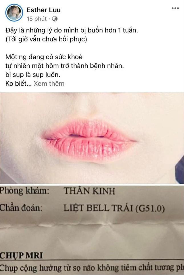 Hari Won chia sẻ về căn bệnh bản thân đang mắc phải. - Ảnh: FB nhân vật. Hari Won chia sẻ về căn bệnh bản thân đang mắc phải. - Ảnh: FB nhân vật.