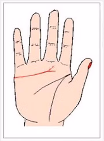 Đường chỉ tay này còn được gọi là đường ly dị.