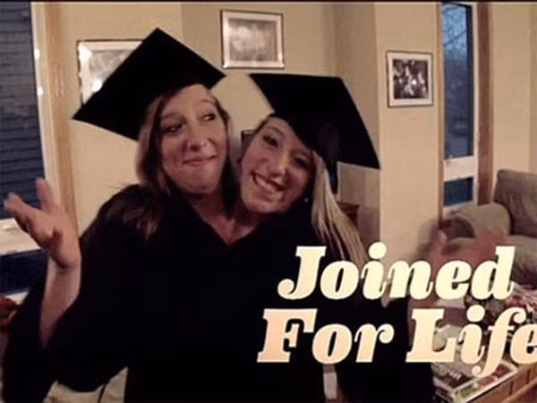 Song sinh dinh lien 4