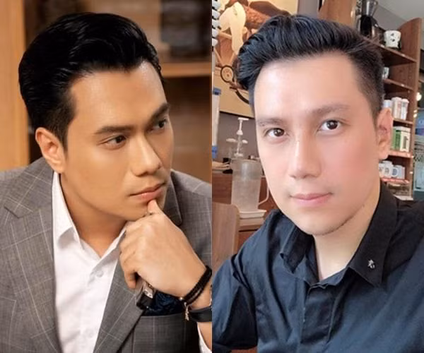 Việt Anh gây hoang mang với gương mặt kém sắc lạ hoắc sau gần 2 tháng phẫu thuật thẩm mỹ-4