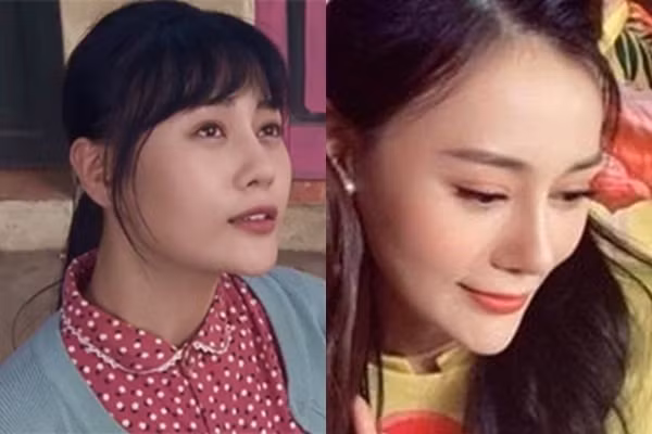 Quỳnh búp bê gây choáng vì sở hữu chiếc cằm xuyên thủng vạn vật 