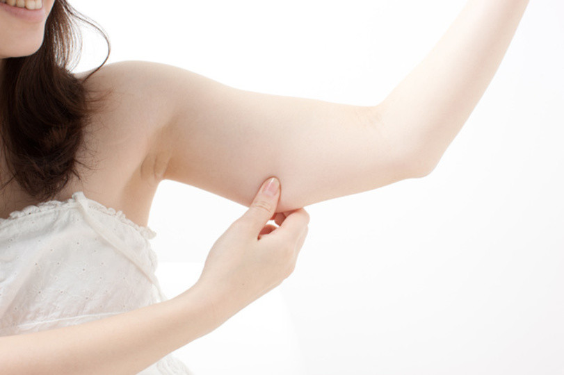 4 cách giảm mỡ bắp tay đơn giản, hiệu quả 100%