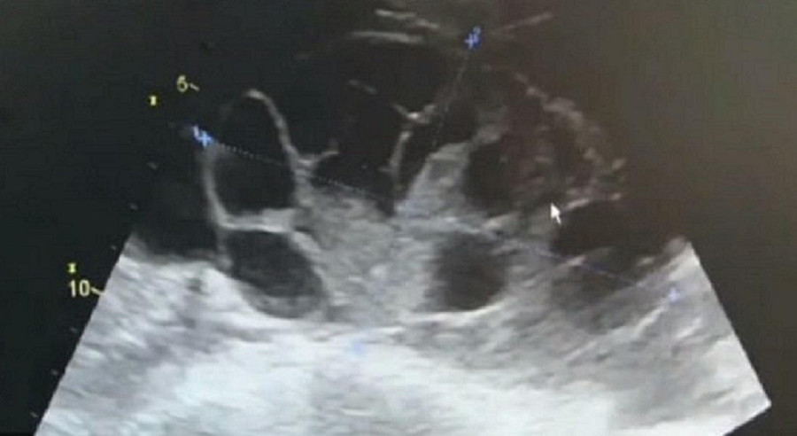 thieu tien mua dien thoai xin, co gai tre suyt mat mang vi lieu minh “ban trung” - 2