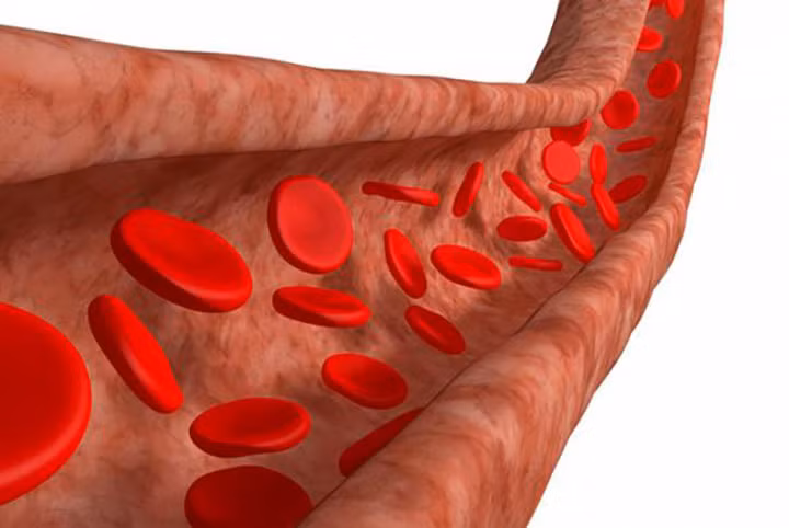 uống nước, uống nước chanh, uống nước ấm, giảm đau, giảm béo, thanh lọc cơ thể, đẹp da, làm đẹp