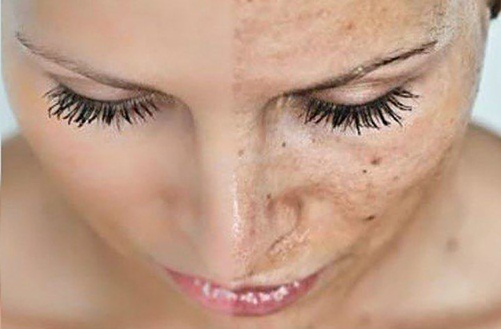 uống nước, uống nước chanh, uống nước ấm, giảm đau, giảm béo, thanh lọc cơ thể, đẹp da, làm đẹp uống nước, uống nước chanh, uống nước ấm, giảm đau, giảm béo, thanh lọc cơ thể, đẹp da, làm đẹp