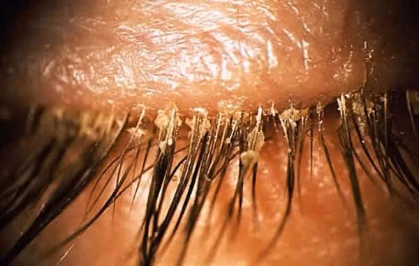 con ai muon noi mi gia khi nhin thay o chay ran ky sinh tren noi "dang song" nay? - 3