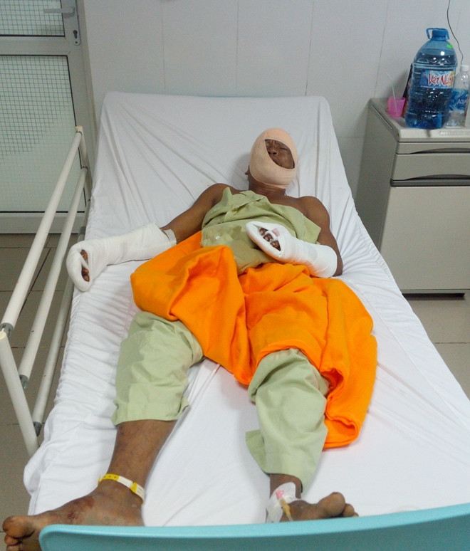 Đang tổ chức đám cưới, cô dâu bị chồng cũ chém nhập viện ảnh 1 Đang tổ chức đám cưới, cô dâu bị chồng cũ chém nhập viện ảnh 1