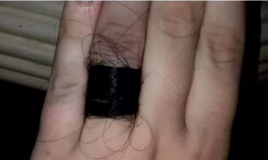Cô gái khoe nhẫn đính hôn, nhưng chất liệu của nó khiến nhiều người rùng mình ảnh 1 Cô gái khoe nhẫn đính hôn bện tóc người, dân mạng hoảng hồn