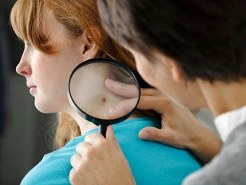 dấu hiệu ung thư, điều trị ung thư, điều trị ung thư dấu hiệu ung thư, điều trị ung thư, điều trị ung thư