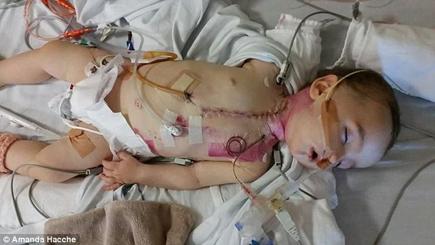 Bé 8 tháng tuổi bị tàn tật vĩnh viễn do nuốt phải thứ nhiều cha mẹ không chú ý đến và hay vứt linh tinh quanh nhà - Ảnh 2. Bé 8 tháng tuổi bị tàn tật vĩnh viễn do nuốt phải thứ nhiều cha mẹ không chú ý đến và hay vứt linh tinh quanh nhà - Ảnh 2.