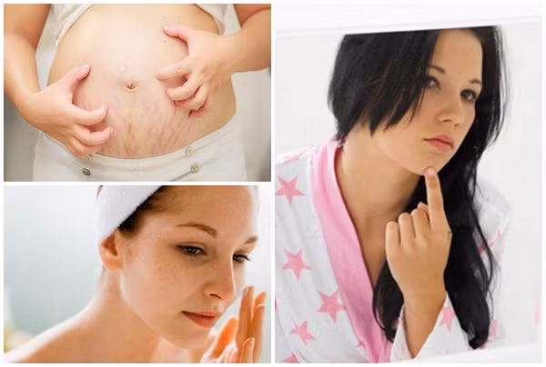 Mẹ bầu có 4 bộ phận này càng xấu xí, thâm đen chứng tỏ thai nhi càng khỏe mạnh