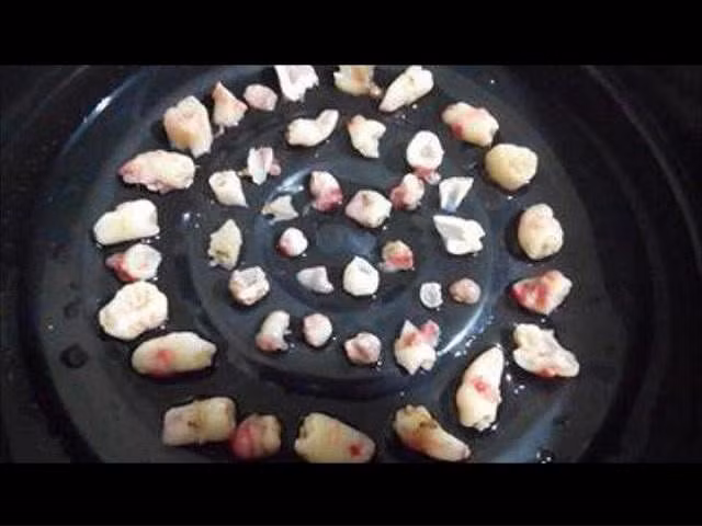 Bé trai 2 tuổi có 50 chiếc răng, 7 năm sau nhìn phim chụp khoang miệng ai cũng sững sờ - Hình 2