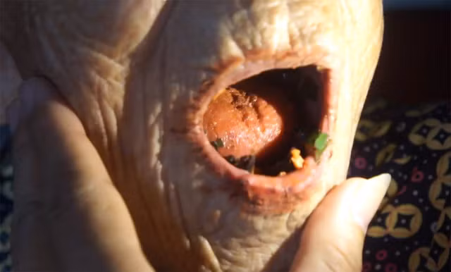 Hàm dưới cụ Đang có 4 vật cứng nhô lên, nghi răng mới mọc.