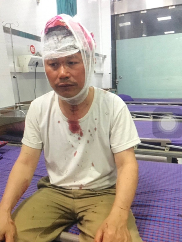 Vết thương trên đỉnh đầu ông Thiêm được bác sĩ phẫu thuật và băng bó. Ảnh: Gia đình bị hại cung cấp