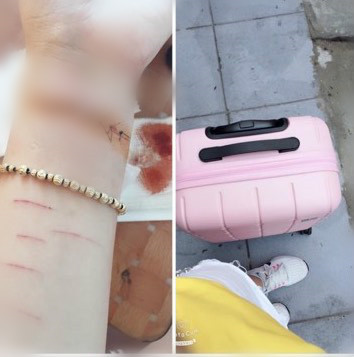 Co gai Sai Gon dung dao lam rach tay vi bi ban trai phan boi hinh anh 1